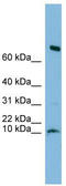 Chromosome 1 Open Reading Frame 122 antibody, TA337612, Origene, Western Blot image 