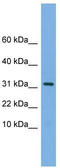 Mitochondrial Ribosomal Protein S6 antibody, TA338949, Origene, Western Blot image 