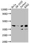 ISL LIM Homeobox 1 antibody, CSB-RA582994A0HU, Cusabio, Western Blot image 