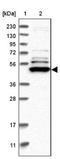 TRNA Methyltransferase 61B antibody, NBP1-83640, Novus Biologicals, Western Blot image 
