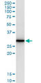 Amphiregulin antibody, LS-C196683, Lifespan Biosciences, Western Blot image 