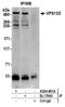 Vacuolar Protein Sorting 13 Homolog D antibody, A304-691A, Bethyl Labs, Immunoprecipitation image 
