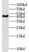 Protein Arginine Methyltransferase 6 antibody, FNab06792, FineTest, Western Blot image 