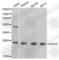 Pyrimidinergic Receptor P2Y6 antibody, A2485, ABclonal Technology, Western Blot image 