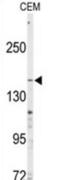 ATP Binding Cassette Subfamily C Member 4 antibody, abx033394, Abbexa, Western Blot image 