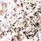 Nuclear Receptor Corepressor 2 antibody, orb315628, Biorbyt, Immunohistochemistry paraffin image 