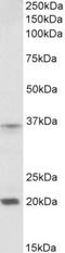 Homeobox A9 antibody, NBP1-52166, Novus Biologicals, Western Blot image 