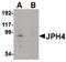 Junctophilin 4 antibody, PA5-20646, Invitrogen Antibodies, Western Blot image 