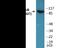 Nuclear factor NF-kappa-B p105 subunit antibody, EKC1951, Boster Biological Technology, Western Blot image 