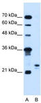 Motile sperm domain-containing protein 3 antibody, TA335974, Origene, Western Blot image 