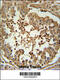 Divergent Protein Kinase Domain 2A antibody, 64-192, ProSci, Immunohistochemistry frozen image 