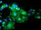 Docking Protein 7 antibody, MA5-25985, Invitrogen Antibodies, Immunocytochemistry image 