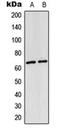 p65 antibody, orb223996, Biorbyt, Western Blot image 
