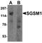 Small G Protein Signaling Modulator 1 antibody, orb75845, Biorbyt, Western Blot image 