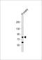DEAD-Box Helicase 4 antibody, 57-434, ProSci, Western Blot image 