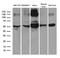 Thioredoxin Reductase 1 antibody, LS-C795926, Lifespan Biosciences, Western Blot image 