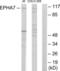 EPH Receptor A7 antibody, LS-C119058, Lifespan Biosciences, Western Blot image 