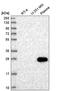 Heat Shock Transcription Factor 4 antibody, HPA048584, Atlas Antibodies, Western Blot image 