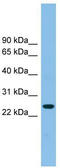 Tetraspanin 4 antibody, TA336051, Origene, Western Blot image 