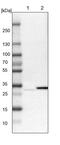 TatD DNase Domain Containing 1 antibody, PA5-54853, Invitrogen Antibodies, Western Blot image 