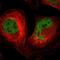 Sarcoma antigen 1 antibody, NBP1-84355, Novus Biologicals, Immunocytochemistry image 