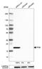 Peptidylprolyl Isomerase B antibody, AMAb91249, Atlas Antibodies, Western Blot image 