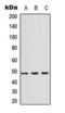 Interleukin 13 Receptor Subunit Alpha 1 antibody, orb393330, Biorbyt, Western Blot image 