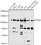 Cleavage and polyadenylation specificity factor subunit 2 antibody, GTX66036, GeneTex, Western Blot image 