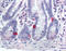 Sodium Voltage-Gated Channel Alpha Subunit 9 antibody, TA341202, Origene, Immunohistochemistry paraffin image 
