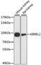 Kirre Like Nephrin Family Adhesion Molecule 2 antibody, LS-C748191, Lifespan Biosciences, Western Blot image 