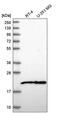 Nucleolar Pre-RRNA Processing Protein NIP7 antibody, PA5-65279, Invitrogen Antibodies, Western Blot image 