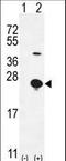 Epigen antibody, LS-C203660, Lifespan Biosciences, Western Blot image 