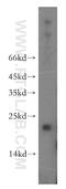 Anaphase Promoting Complex Subunit 11 antibody, 15065-1-AP, Proteintech Group, Western Blot image 