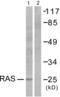 Ras antibody, abx013185, Abbexa, Western Blot image 