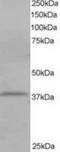 Cytohesin 1 Interacting Protein antibody, TA302771, Origene, Western Blot image 