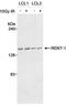 hUpf1 antibody, A300-036A, Bethyl Labs, Western Blot image 