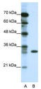 Ts Translation Elongation Factor, Mitochondrial antibody, TA343559, Origene, Western Blot image 