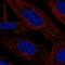 Lamin Tail Domain Containing 2 antibody, HPA073912, Atlas Antibodies, Immunofluorescence image 