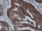 Kinesin Family Member 25 antibody, M14608, Boster Biological Technology, Immunohistochemistry paraffin image 