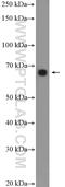 Grainyhead Like Transcription Factor 1 antibody, 17644-1-AP, Proteintech Group, Western Blot image 