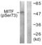 Melanocyte Inducing Transcription Factor antibody, abx012444, Abbexa, Western Blot image 