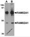 Regulator Of Microtubule Dynamics 2 antibody, 5697, ProSci, Western Blot image 