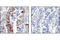 Mechanistic Target Of Rapamycin Kinase antibody, 2976L, Cell Signaling Technology, Immunohistochemistry paraffin image 