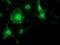 Potassium Channel Tetramerization Domain Containing 14 antibody, MA5-25478, Invitrogen Antibodies, Immunocytochemistry image 