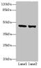 Terminal Nucleotidyltransferase 5B antibody, orb354867, Biorbyt, Western Blot image 