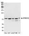 Cytoplasmic dynein 1 intermediate chain 2 antibody, A304-529A, Bethyl Labs, Western Blot image 