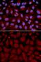 Butyrylcholinesterase antibody, GTX30084, GeneTex, Immunofluorescence image 