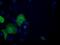 ATP Citrate Lyase antibody, GTX84967, GeneTex, Immunofluorescence image 