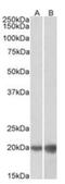 Deoxyuridine Triphosphatase antibody, orb308875, Biorbyt, Western Blot image 