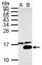 Galectin 7B antibody, NBP2-21574, Novus Biologicals, Western Blot image 
